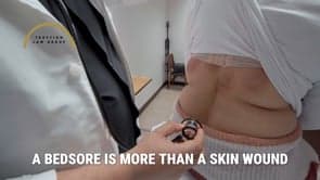 Video thumbnail for Bedsore Lawyer | File a Pressure Ulcer Negligence Lawsuit